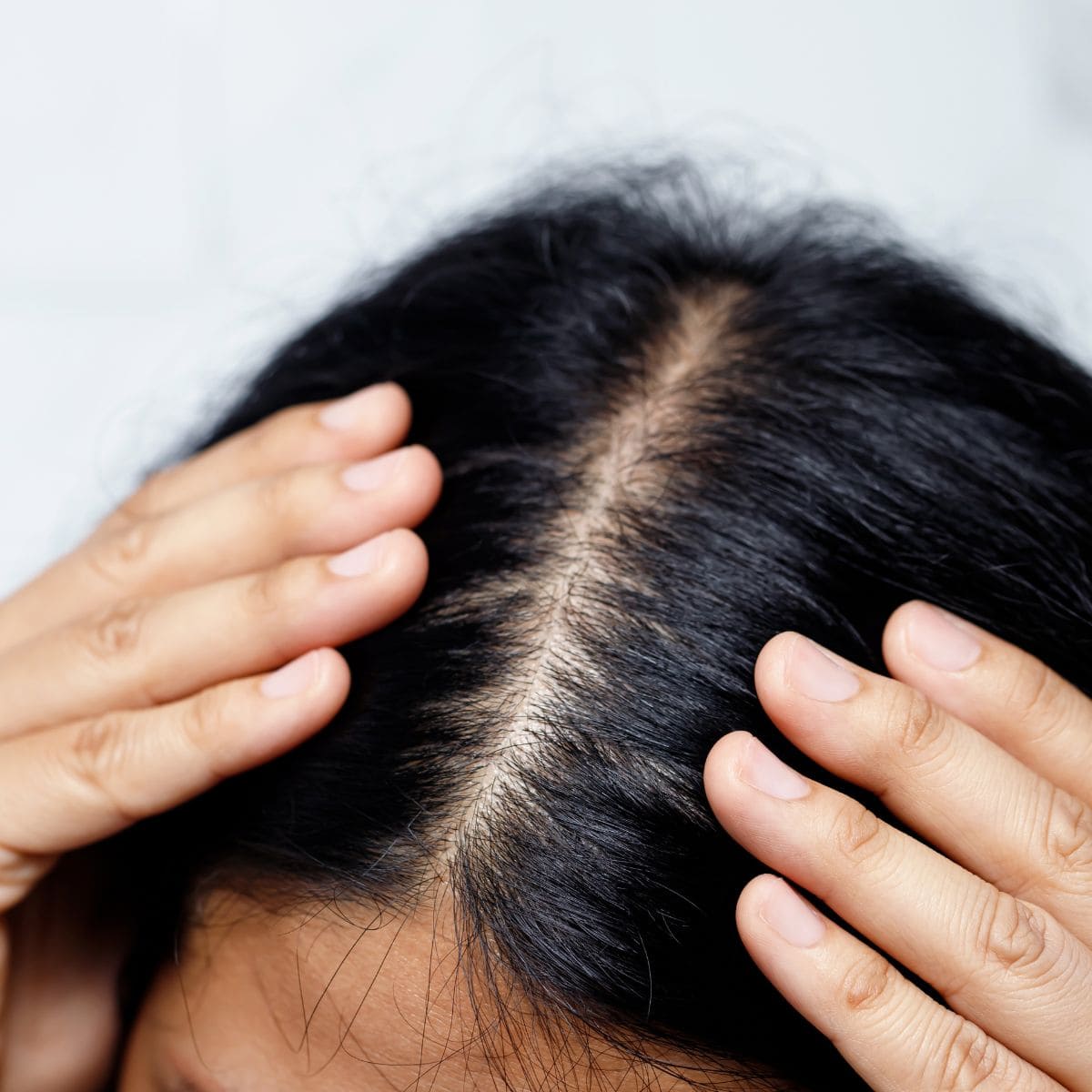 tratamentos para cabelos danificados a raiz